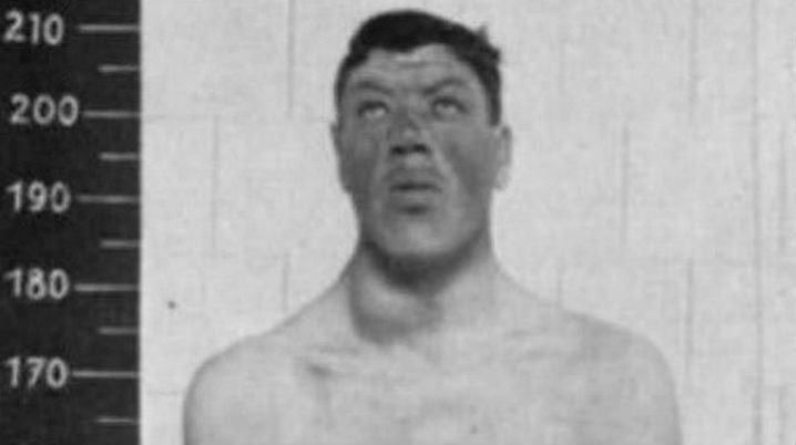 Adam Rainer: El hombre que sufrió enanismo y gigantismo